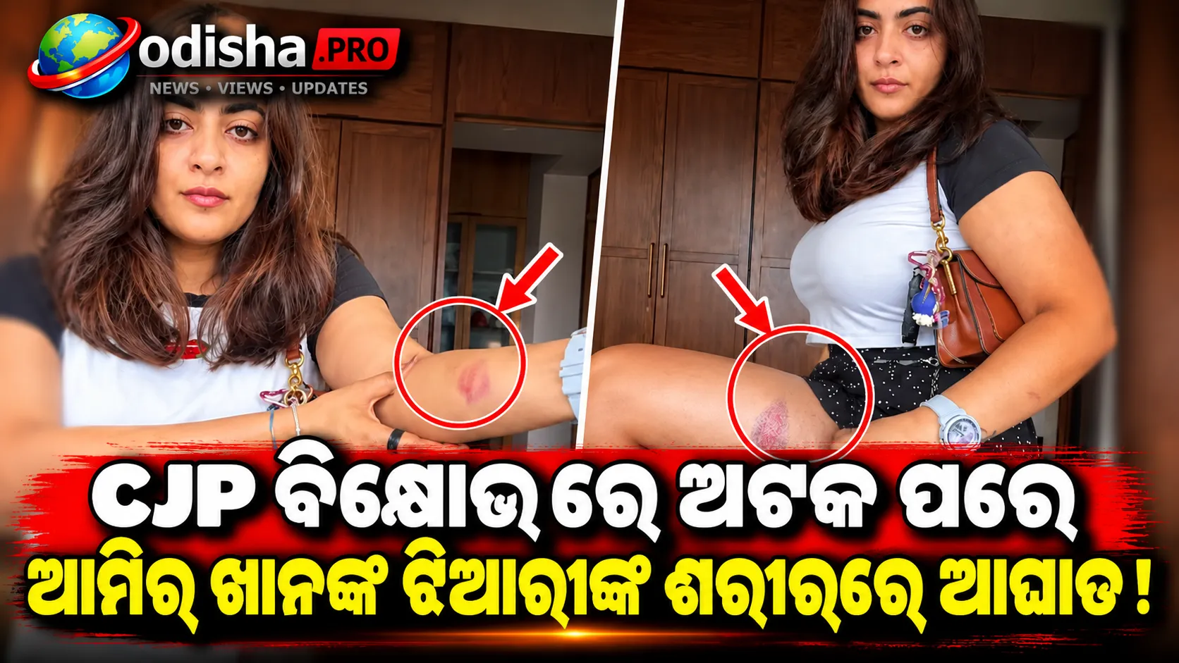 CJP ବିକ୍ଷୋଭ ବେଳେ ଅଟକ ପରେ ଆମିର ଖାନଙ୍କ ଝିଆରୀ ଜାୟନ ମାରିଙ୍କ ଶରୀରରେ ଆଘାତ ଚିହ୍ନ!