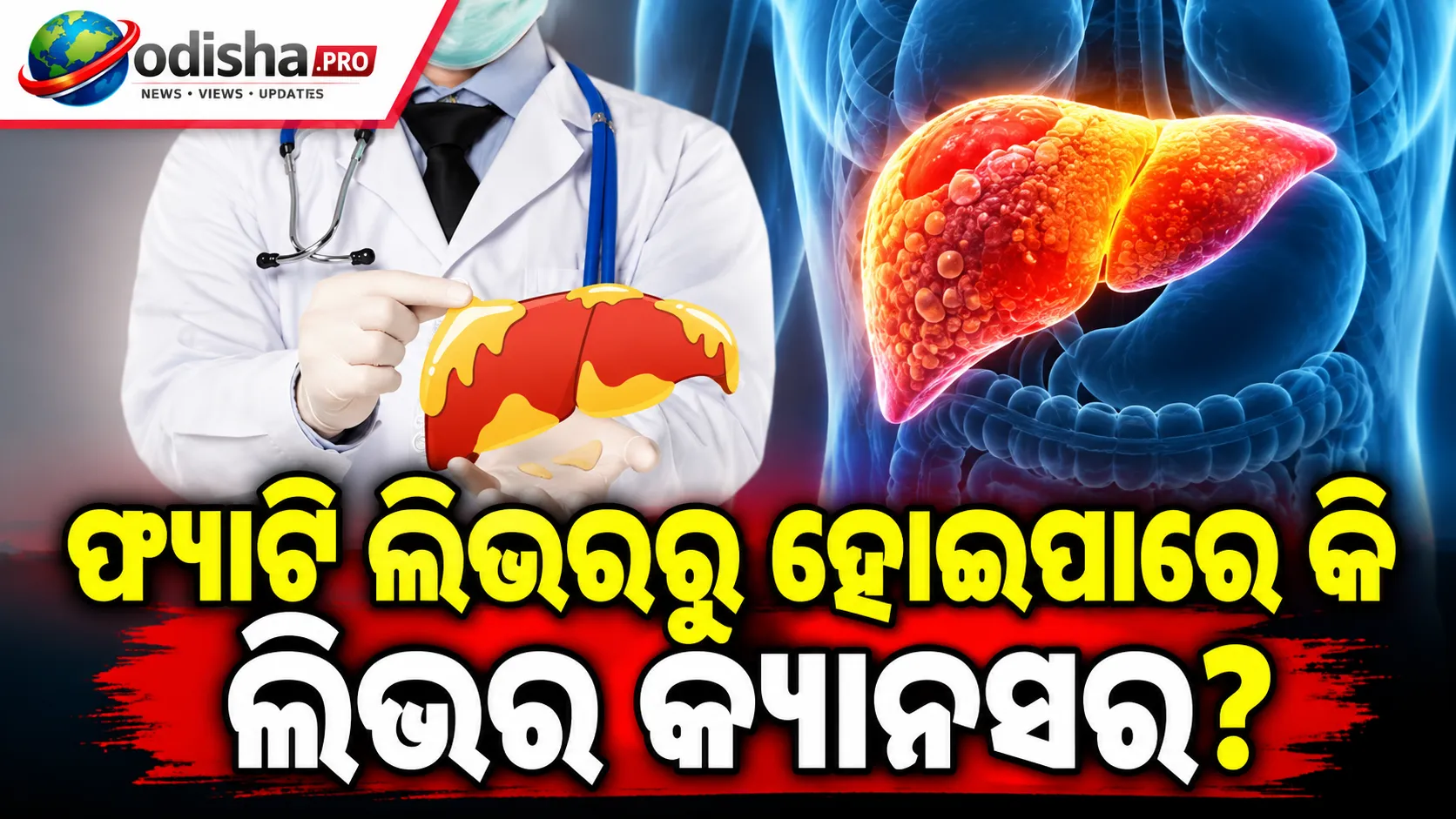 ଫ୍ୟାଟି ଲିଭରରୁ ହୋଇପାରେ କି ଲିଭର କ୍ୟାନସର? ଜାଣନ୍ତୁ କେଉଁମାନେ ଅଧିକ ବିପଦରେ