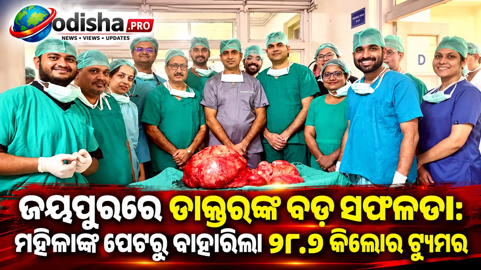 ଜୟପୁରରେ ଡାକ୍ତରଙ୍କ ବଡ଼ ସଫଳତା: ମହିଳାଙ୍କ ପେଟରୁ ବାହାରିଲା ୨୮.୬ କିଲୋର ଟ୍ୟୁମର