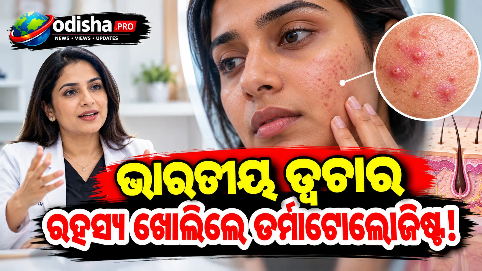 ଭାରତୀୟ ତ୍ୱଚାରେ କାହିଁକି ଭଲ ହେଉନି ଆକ୍ନେ? ଡର୍ମାଟୋଲୋଜିଷ୍ଟ ଡା. ଜୁଶ୍ୟା ଭାଟିଆ ସରିନ୍‌ଙ୍କ ବଡ଼ ଖୁଲାସା