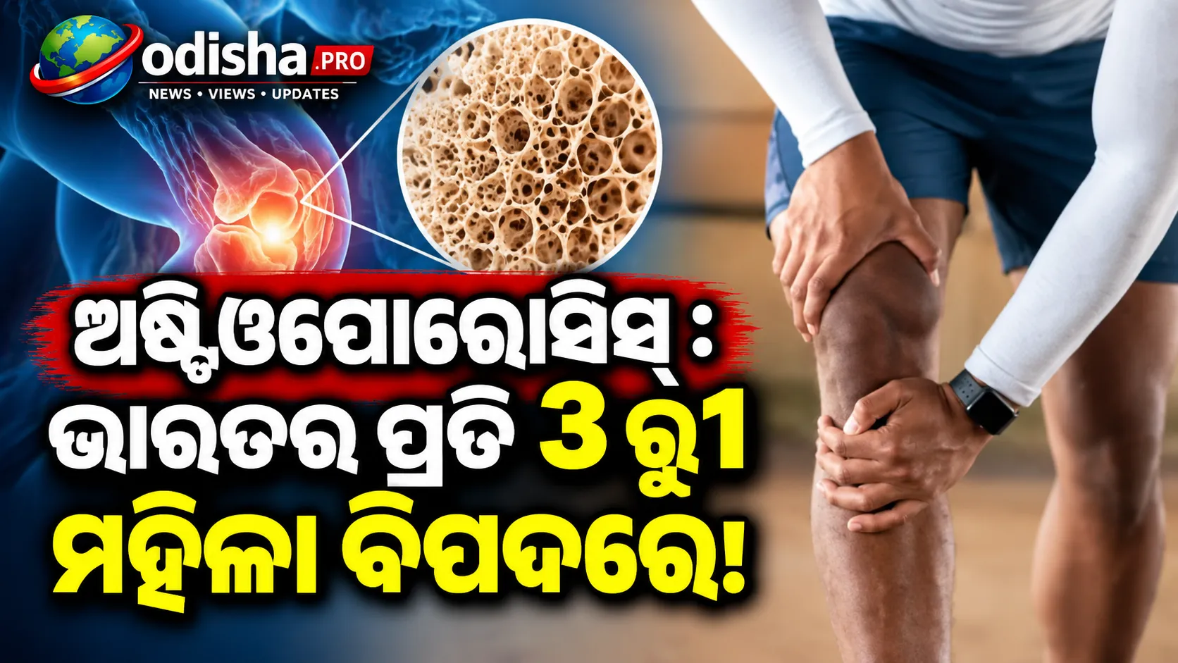 ୫୦ ବର୍ଷରୁ ଅଧିକ ବୟସର ପ୍ରତି ୩ ମହିଳାଙ୍କ ମଧ୍ୟରୁ ଜଣଙ୍କୁ ହାଡ଼ ଭାଙ୍ଗିବାର ବିପଦ! ଚିହ୍ନଟ କରିବ ନୂଆ ସ୍କୋରକାର୍ଡ