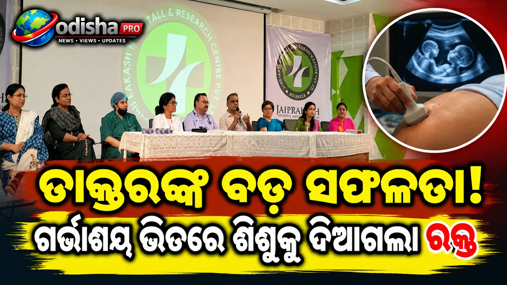 ରାଉରକେଲାରେ ପ୍ରଥମ ସଫଳ ଗର୍ଭାଶୟ ଭିତରେ ରକ୍ତ ସଞ୍ଚାର! ମା’ଙ୍କ ଗର୍ଭରେ ଶିଶୁକୁ ମିଳିଲା ନୂଆ ଜୀବନ