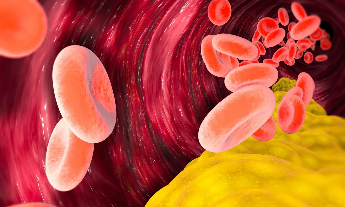 VLDL Cholesterol: The Hidden Heart Risk You Should Know About