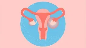 PCOD Weight Gain: Why Hormones Matter More Than Calories, Experts Explain