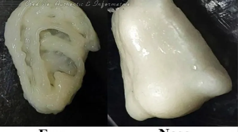 ଏନ୍‌ଆଇଟି ରାଉରକେଲାର ବୈଜ୍ଞାନିକ ସଫଳତା : ଟିସ୍ୟୁ ଗଠନ ପାଇଁ ନୂତନ 3D ବାୟୋ-ଇଙ୍କ ପେଟେଣ୍ଟ