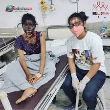 ରାଉରକେଲାରେ ଲୋମହର୍ଷଣକାରୀ ଘଟଣା: ଘରେ ଶୋଇଥିବା ଯୁବତୀଙ୍କୁ ପେଟ୍ରୋଲ ଢାଳି ଜୀବନ୍ତ ଜାଳିଦେଲେ ଦୁର୍ବୃତ୍ତ, ଅବସ୍ଥା ଗୁରୁତର