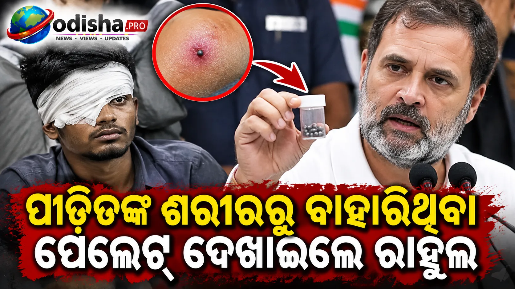 ପୀଡ଼ିତଙ୍କ ଶରୀରରୁ ବାହାରିଥିବା ପେଲେଟ୍ ଦେଖାଇଲେ ରାହୁଲ, କହିଲେ- ଶରୀରରେ ୨୦୦ରୁ ଅଧିକ