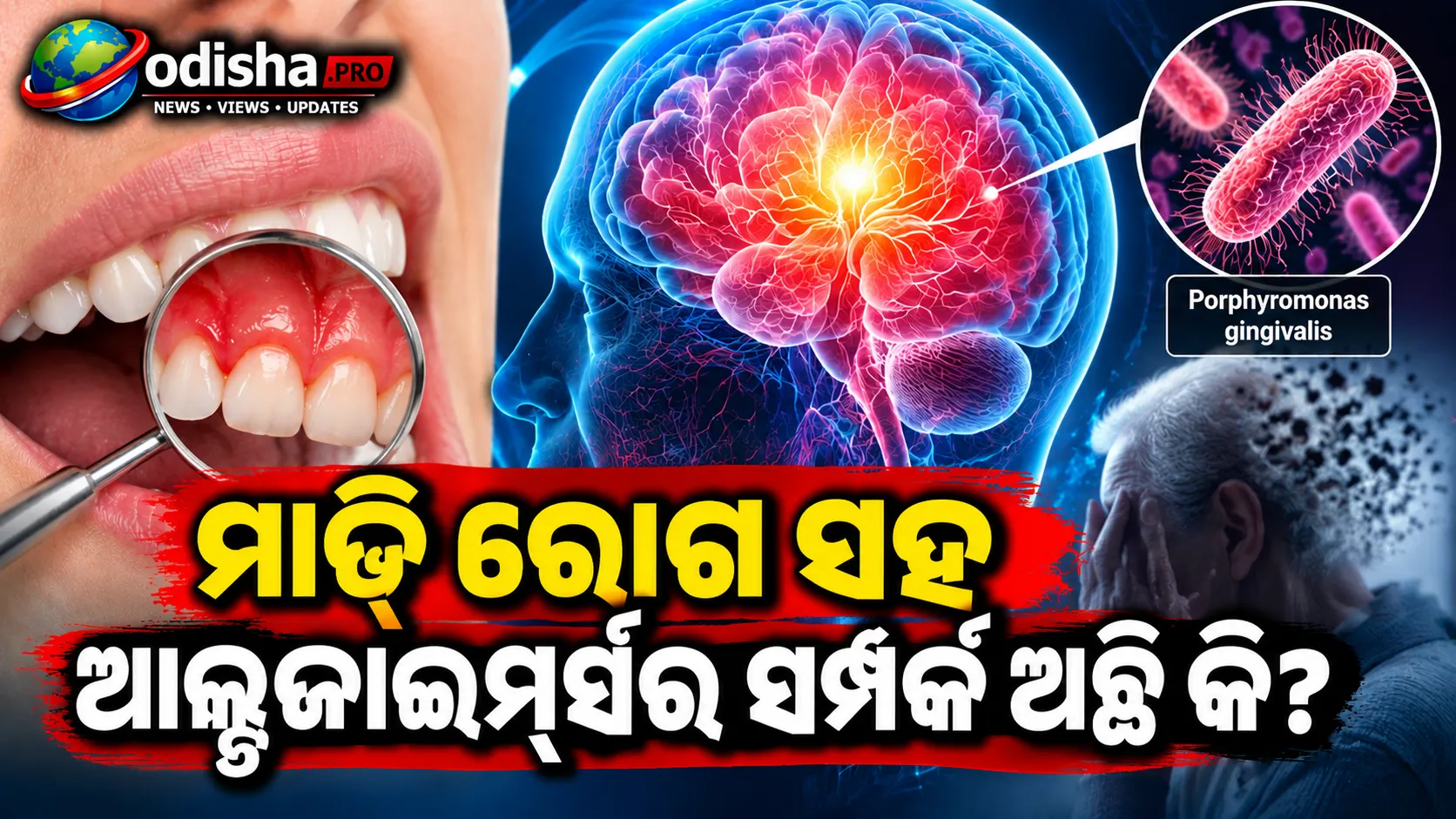 ମାଢ଼ି ରୋଗ ସହ ଆଲ୍‌ଜାଇମର୍ସର ସମ୍ପର୍କ ଅଛି କି? ଅଧ୍ୟୟନରେ ମିଳିଲା ଏହି ଚମକାଇଦେବା ତଥ୍ୟ