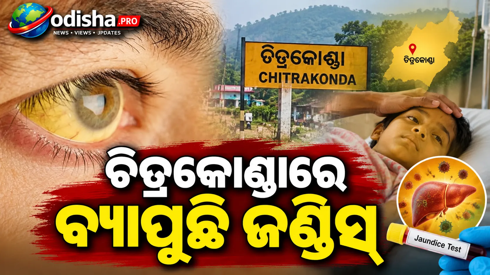 ଚିତ୍ରକୋଣ୍ଡାରେ ବ୍ୟାପୁଛି ଜଣ୍ଡିସ, ମେଡିକାଲ ବଦଳରେ ଦେଶୀ ଚିକିତ୍ସା ଉପରେ ଭରସା